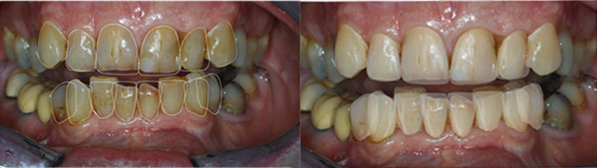 dental photo before treatment 1